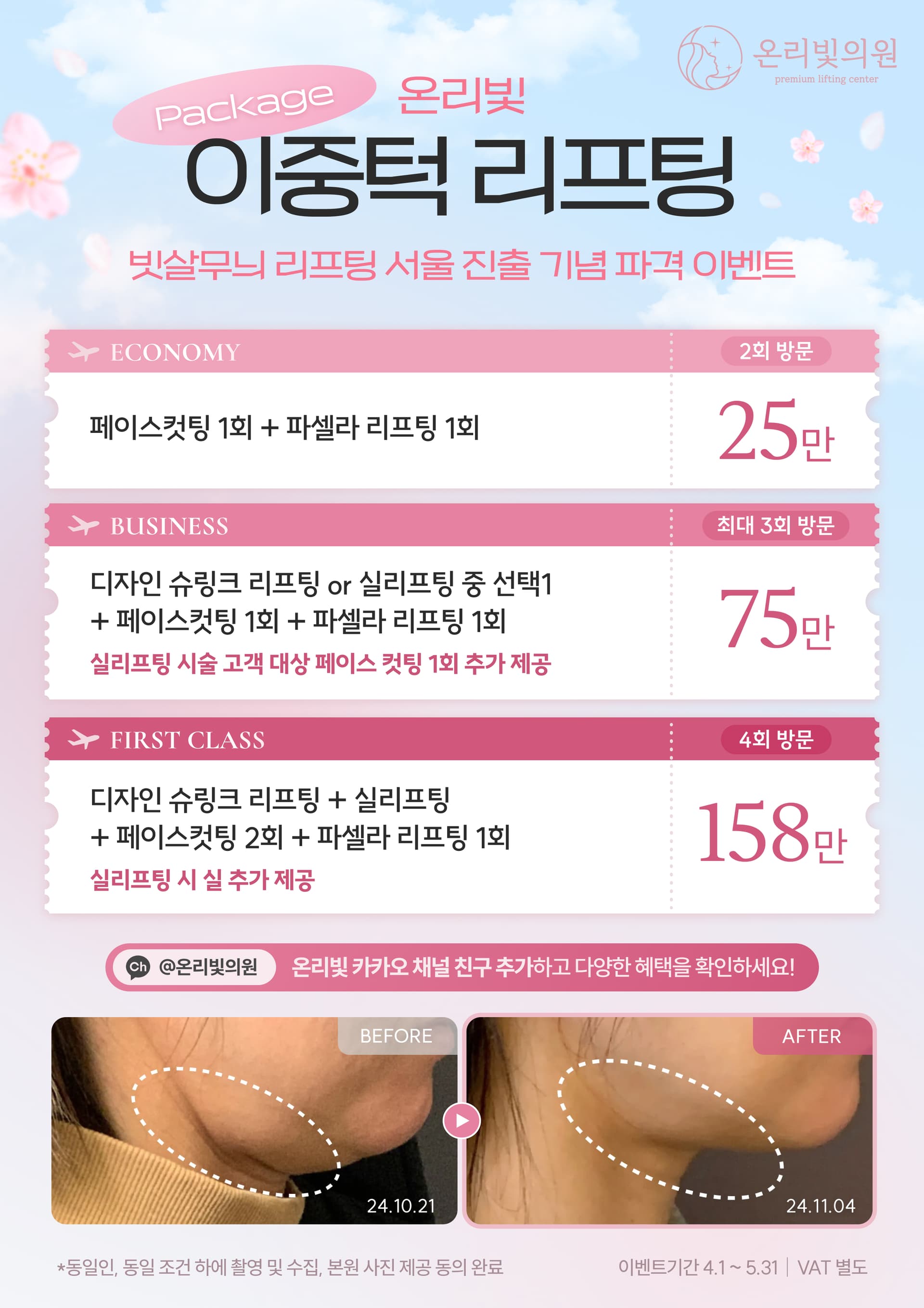 온리빛 이중턱 리프팅 패키지